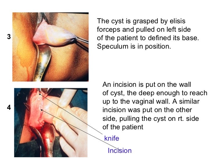 Fat girls bondage tube Vagina not deep enough